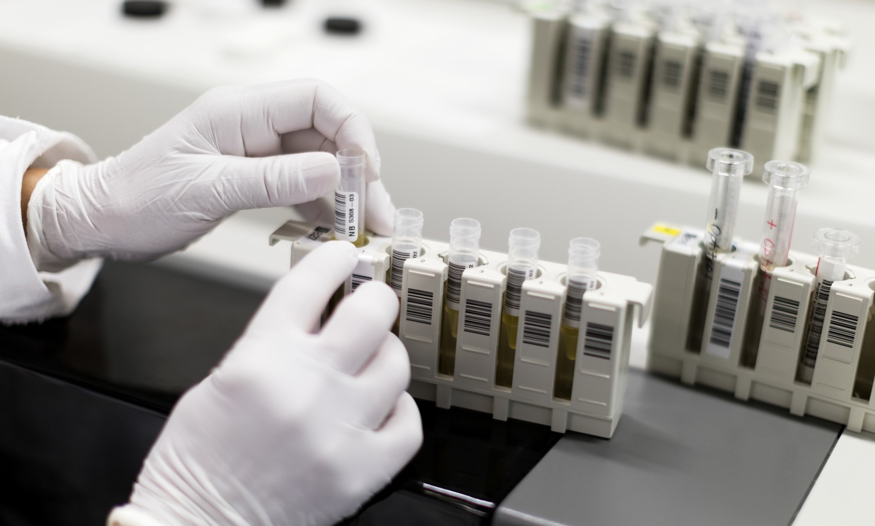 Test Auf Sexuell übertragbare Krankheiten Gratistest für sexuelle übertragbare Krankheiten von Kanton abgelehnt