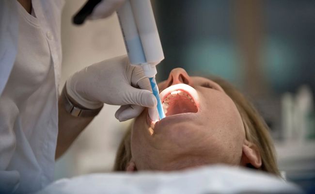 Coltene will nach einer Delle wieder einen Zahn zulegen